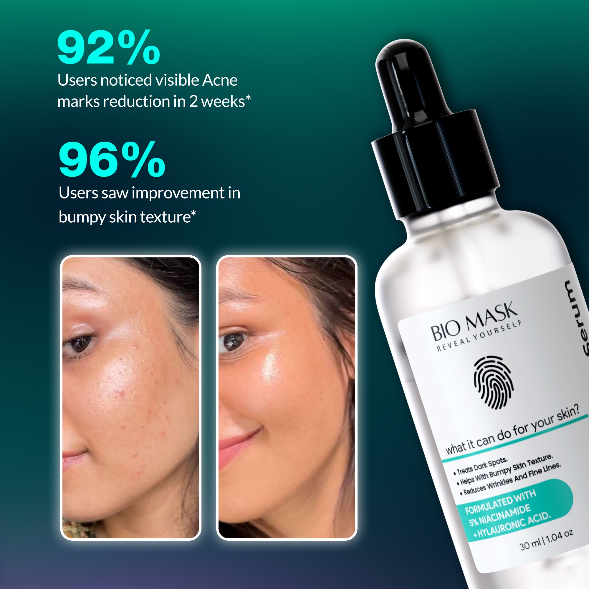 Bio Mask serum bottle with before and after skin comparison on a green and blue gradient background